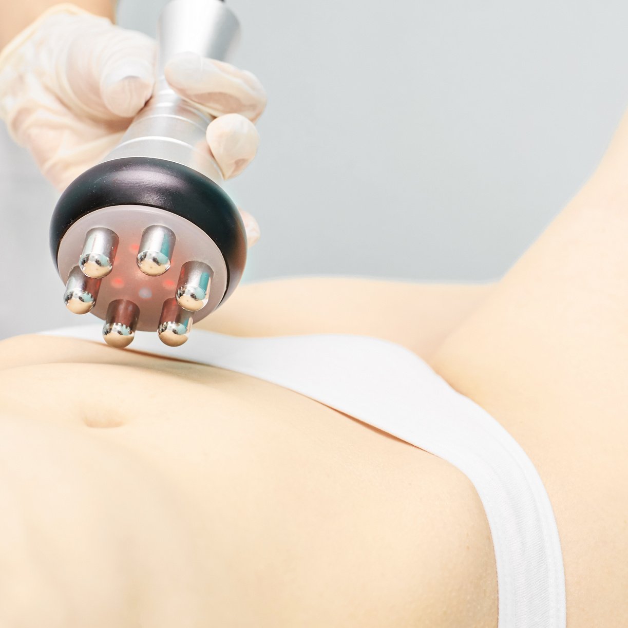 Close-up of a Radio Frequency Skin Tightening Device